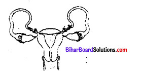 Bihar Board 12th Biology Objective Answers Chapter 4 जनन स्वास्थ्य 1